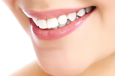 The image is a close-up photograph of a person s face, focusing on their teeth and lips.