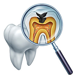 An illustration of a dental tooth with an X-ray image showing the internal structure, including the pulp and roots, viewed through a magnifying glass.