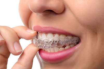 Woman with braces holding a toothpaste tablet.