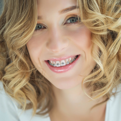 A smiling woman with braces, wearing a white top and curly hair.