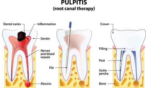 The image depicts a detailed illustration of the human dental anatomy, showing teeth, gums, and internal structures such as roots, nerves, and blood vessels. It also includes labels indicating different parts of the mouth, like the pulpit, crown, and dentin.