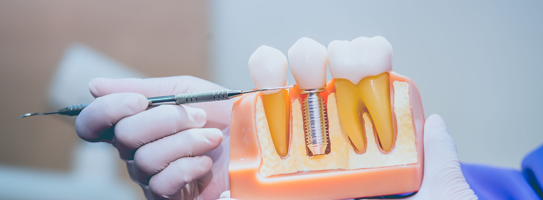 The image shows a person s hand holding a toothbrush with a small amount of toothpaste on it, positioned in front of an open mouth model.